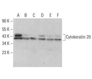 western blotting image from recommended Cytokeratin 20 (E-9) monoclonal antibody replacement. Image 381323