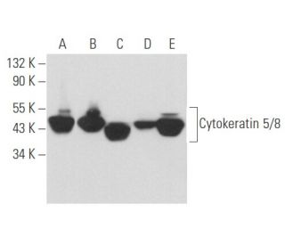 Cytokeratin 5/8 Antibody (C50) - Western Blotting - Image 357427 