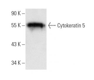 western blotting image from recommended Cytokeratin 5 (RCK103) monoclonal antibody replacement. Image 9889