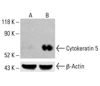 Cytokeratin 5 Antibody (AE14) - Western Blotting - Image 413357 