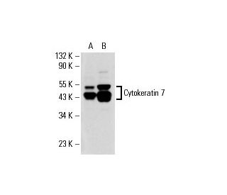 Cytokeratin 7 Antibody (5F282) - Western Blotting - Image 17708 