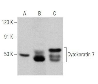 western blotting image from recommended Cytokeratin 7 (RCK105) monoclonal antibody replacement. Image 356323