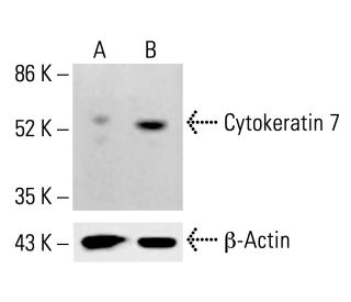 Cytokeratin 7 Antibody (LP1K) - Western Blotting - Image 413064 