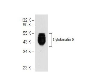 Cytokeratin 8 Antibody (M20) - Western Blotting - Image 82618 