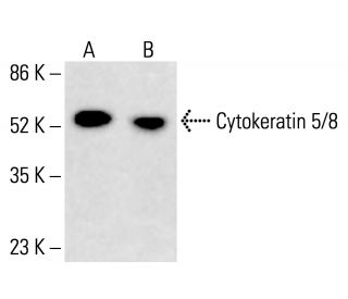 Cytokeratin 5/8 Antibody (RCK102) - Western Blotting - Image 413026 