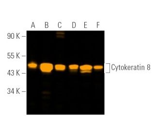 Cytokeratin 8 Antibody (C51) - Western Blotting - Image 390729 