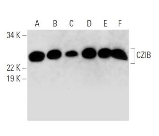 CZIB Antibody (H-5) - Western Blotting - Image 290879 