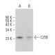 CZIB Antibody (H-9) - Western Blotting - Image 371055