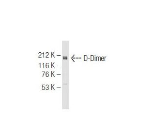 D-Dimer Antibody (DD1) - Western Blotting - Image 64643
