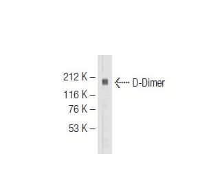 D-Dimer Antibody (DD3) - Western Blotting - Image 64646