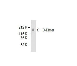 D-Dimer Antibody (DD5) - Western Blotting - Image 64648