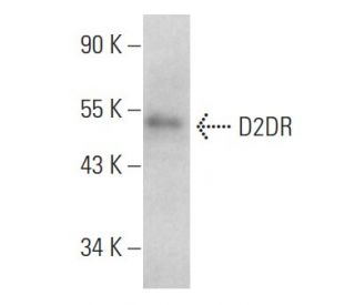 D2DR/Dopamine D2 Receptor Antibody (B-10) - Western Blotting - Image 353730 