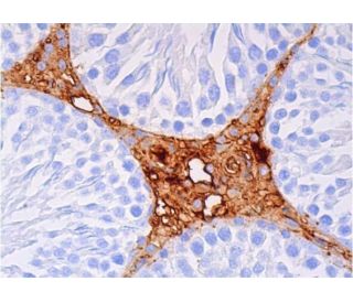 western blotting image from recommended D3DR (9F4) monoclonal antibody replacement. Image 384573