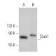 western blotting image from recommended Dab1 (G-5) monoclonal antibody replacement. Image 363512