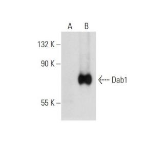 Dab1 Antibody (G-5)