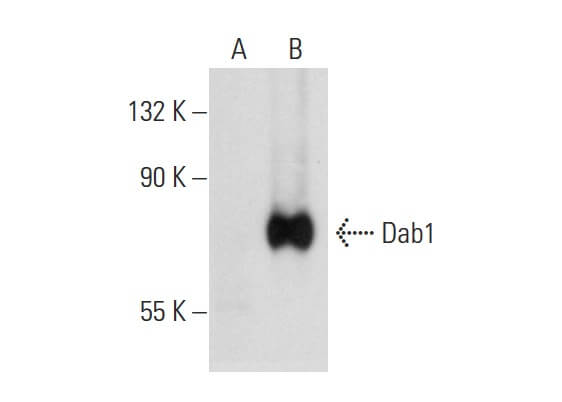 Dab1 Antibody (G-5) | SCBT - Santa Cruz Biotechnology