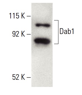 Dab1 Antibody (G-5) | SCBT - Santa Cruz Biotechnology