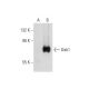 Dab1 (G-5): sc-271136. Western blot analysis of Dab1 expression in non-transfected: sc-117752 (A) and human Dab1 transfect