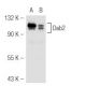 Dab2 Antibody (B-3) - Western Blotting - Image 46205 