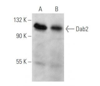 Dab2 Antibody (C-1) - Western Blotting - Image 356548 