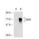 Dab2 Antibody (D-6) - Western Blotting - Image 51969