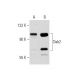 Dab2 Antibody (D-6) - Western Blotting - Image 289893 