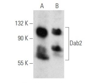 Dab2 Antibody (D-6) - Western Blotting - Image 356547 