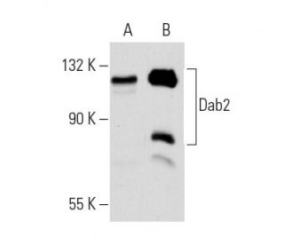 western blotting image from recommended Dab2 (E-11) monoclonal antibody replacement. Image 289892