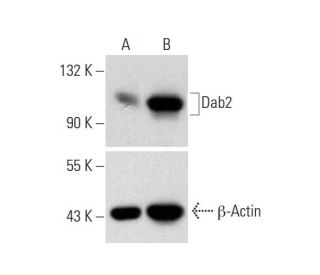 Dab2 CRISPR Activation Plasmid (m): sc-419936-ACT. Western blot analysis of Dab2 expression in non-transfected control (A)