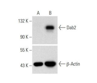 Dab2 CRISPR Activation Plasmid (m): sc-419936-ACT. Western blot analysis of Dab2 expression in non-transfected control (A) 