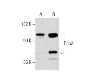 Dab2 Antibody (D-6) - Western Blotting - Image 289893