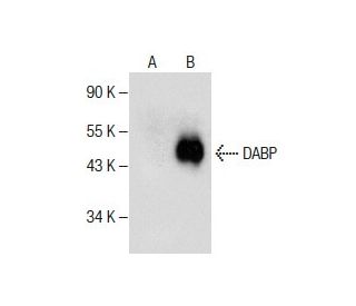 DABP Antibody (H-6) - Western Blotting - Image 286741 