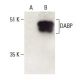 DABP Antibody (H-6) - Western Blotting - Image 397982