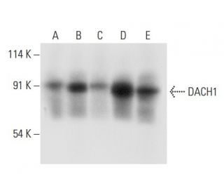 DACH1 Antibody (A-6) - Western Blotting - Image 308116The Double Nickase Plasmid features a U6 promoter for sgRNA expression, a 20 nt targeting sequence, and a gRNA scaffold to guide Cas9n. It includes a CBh promoter for Cas9n (D10A) and puromycin resistance, GFP for transfection verification, and nuclear localization signals (NLS). The 2A peptide allows co-expression of Cas9n and Puro from a single promoter, enabling precise genome editing with reduced off-target effects.