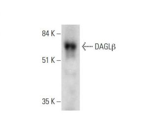 DAGLβ Antibody (A-5) - Western Blotting - Image 331154SAM Transcription Activation: SAM system utilizing dCas9-VP64, MS2-P65-HSF1, and sgRNA for precise gene transcription activation.