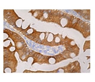 DAK Antibody (A-5) - Immunohistochemistry - Image 161053 