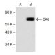 DAK Antibody (A-5) - Western Blotting - Image 141577