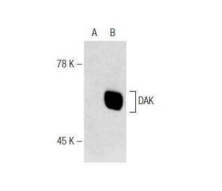 DAK Antibody (G-5) - Western Blotting - Image 146592