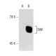 DAK Antibody (G-5) - Western Blotting - Image 146592