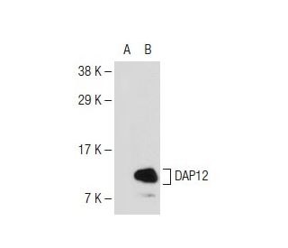 western blotting image from recommended DAP12 (A-4) monoclonal antibody replacement. Image 109719