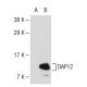 western blotting image from recommended DAP12 (A-4) monoclonal antibody replacement. Image 109719