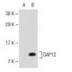 DAP12 Antibody (B-2) - Western Blotting - Image 109723 