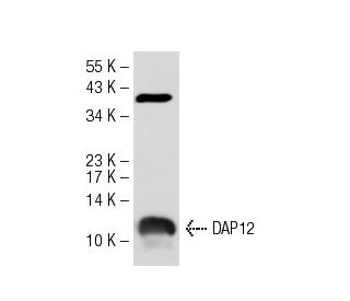 western blotting image from recommended DAP12 (G-5) monoclonal antibody replacement. Image 55648