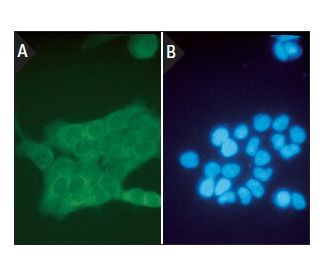 DAPI: sc-3598. Immunofluorescence staining of methanol-fixed KNRK rat cells (A) and control DAPI: sc-3598 nuclear staining 