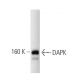 DAPK Antibody (17) - Western Blotting - Image 127465 
