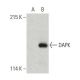 DAPK Antibody (17) - Western Blotting - Image 396369