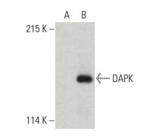DAPK Antibody (17) - Western Blotting - Image 396369The Double Nickase Plasmid features a U6 promoter for sgRNA expression, a 20 nt targeting sequence, and a gRNA scaffold to guide Cas9n. It includes a CBh promoter for Cas9n (D10A) and puromycin resistance, GFP for transfection verification, and nuclear localization signals (NLS). The 2A peptide allows co-expression of Cas9n and Puro from a single promoter, enabling precise genome editing with reduced off-target effects.