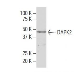 DAPK2 Antibody (X15) - Western Blotting - Image 33745