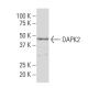 DAPK2 Antibody (X15) - Western Blotting - Image 33745