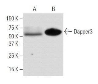 Dapper3 Antibody (2A5) - Western Blotting - Image 67358